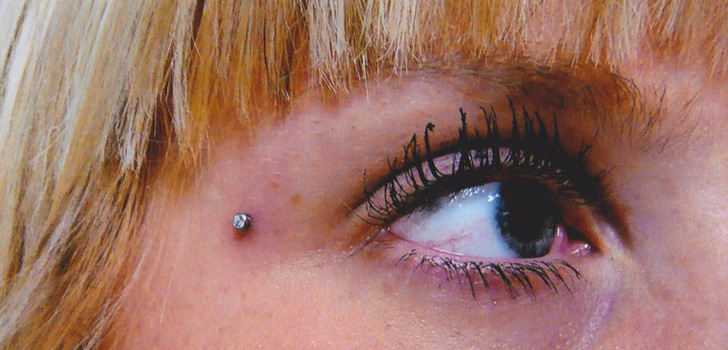 Mikrodermální piercing: jak se mikrodermabry vyrábějí (foto)