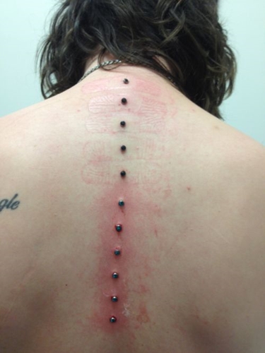 Mikrodermální piercing: jak se mikrodermabry vyrábějí (foto)