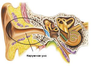 Jak zacházet s otitis v domácnosti?
