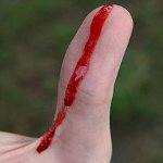 První pomoc při krvácení První pomoc při krvácení