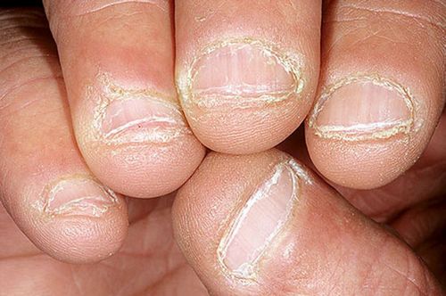 Jak rozpoznat a co dělat v případě metabolických poruch